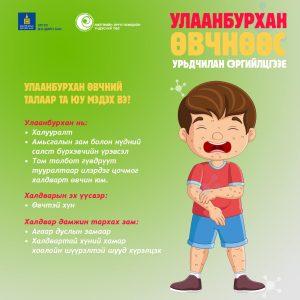 Read more about the article Улаанбурхан өвчний талаар та юу мэдэх вэ?